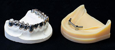 Коронки и мосты изготавливаются на станках Haas